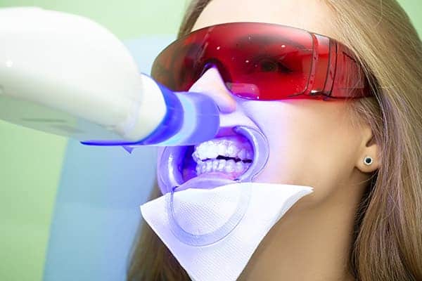 Laser teeth whitening treatments Colchester