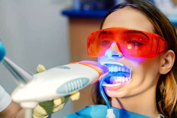 Simplifying Teeth Whitening: A Comprehensive Guide Colchester