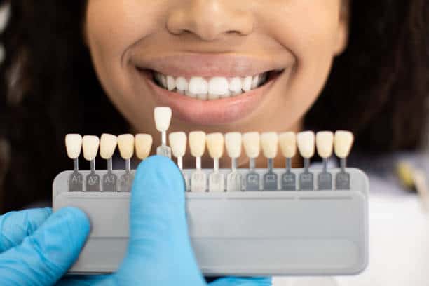 Laser Teeth Whitening: Exploring the Longevity of Your Brighter Smile Colchester