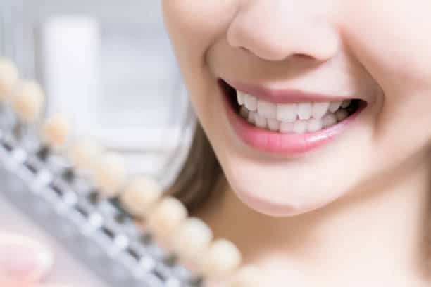 Teeth Whitening Kings Norton Colchester