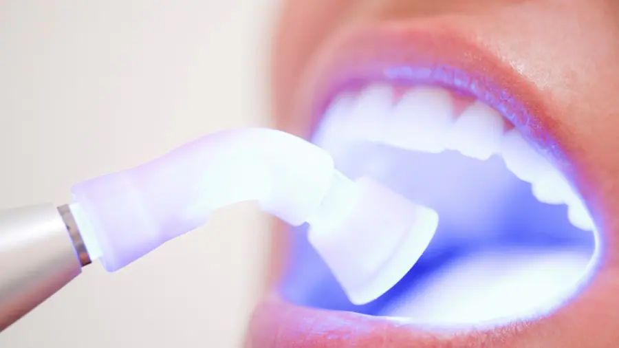 Teeth Whitening Aylesbury Colchester